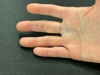 薬丸裕英『麻酔注射激痛！！！』