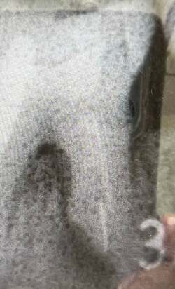  松居直美、大学病院での処置が決定したことを報告「細い針を残されてしまった」 