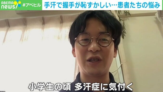 深刻な“手汗”で生活に支障 「電子機器壊しかねない」理解されづらい悩みに保険適用の治療薬も 3枚目