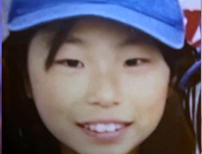 【写真・画像】 「整形総額約1000万円」レスが原因で豊胸した28歳美女「誰かのためにする整形はもうしたくない」26歳無整形イケメンに告白　1枚目