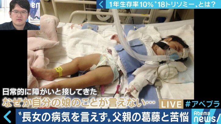 “1年以上の生存率は10％”…18トリソミー児の家族たちが写真展に託した苦悩と葛藤