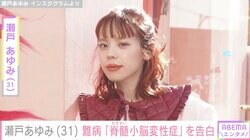 1児の母でモデル・瀬戸あゆみ（31）、指定難病であると公表「小脳がどんどん破壊・消失」症状や公表理由を明かす