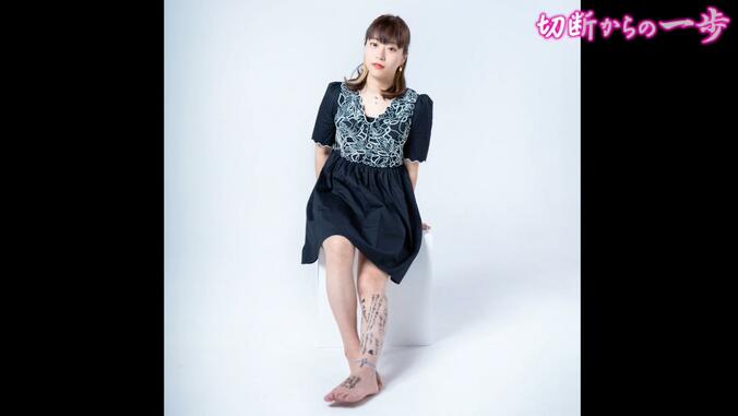 紫乃さん、切断手術の直前に撮られた写真