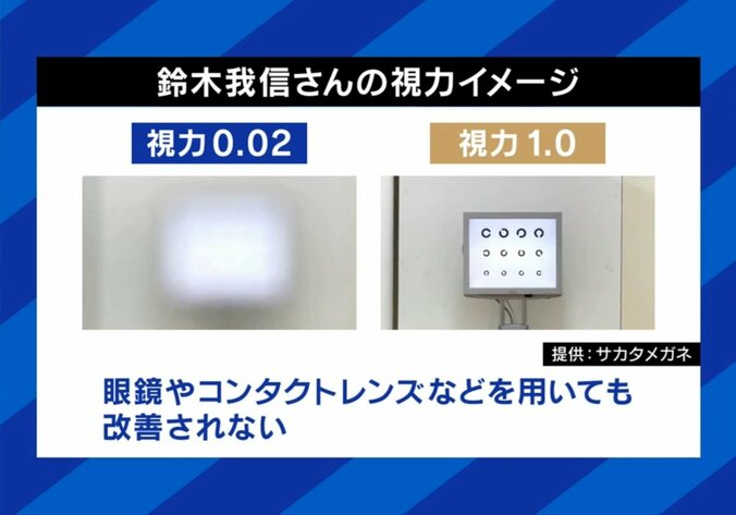 弱視の人の視界