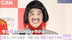 日本エレキテル連合・中野聡子、眼瞼下垂症で手術 テープメイク酷使で「まぶたが終わりました」
