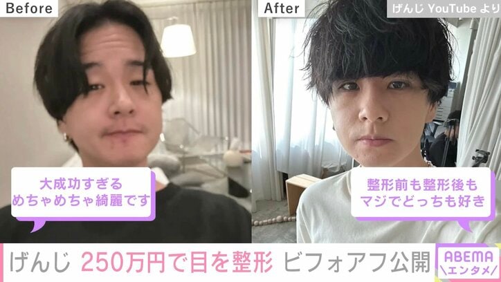 ファッション系YouTuberげんじ、250万円で目を整形しビフォーアフター公開「めちゃめちゃ綺麗」の声