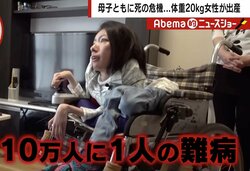 「生まれる可能性は99％ない」と宣告された“体重20kg”の女性が出産　夫婦で乗り越えた葛藤と母子生命の危機