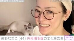 摂食障害公表の遠野なぎこ（44）、円形脱毛症の変化を報告「ストレス」「笑い飛ばせ」