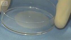 「思いきり走りたい」iPS細胞“移植手術”患者が会見　実用化へ大きな一歩
