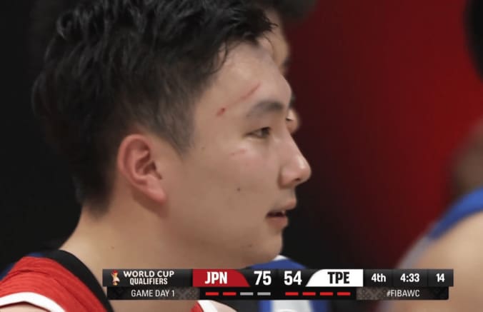 額から血が出てしまった富永啓生