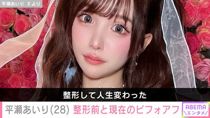 【写真・画像】整形総額2600万円・平瀬あいり（28）、整形前と現在のビフォーアフター公開　1枚目