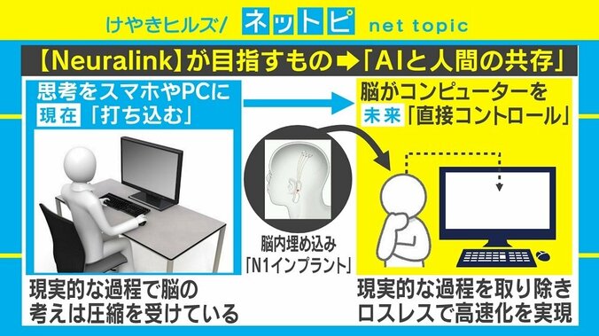 脳内埋め込み“チップ”で考えるだけでスマホ入力！ イーロン・マスク氏の新プロジェクトを徹底解説 2枚目