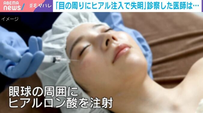 施術を受ける女性（イメージ）