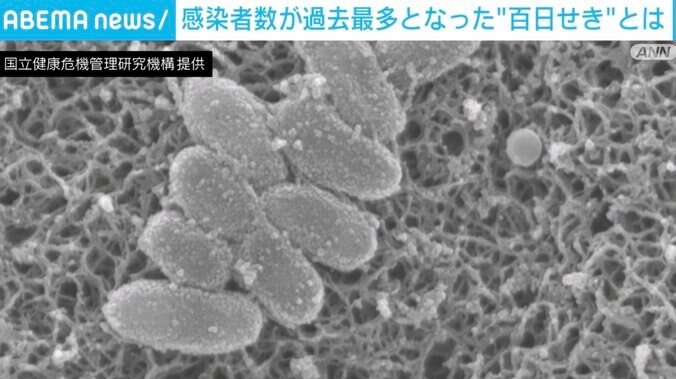 【写真・画像】“百日せき”の患者数が高止まり 専門家「2カ月までの赤ちゃんはけっこう危険」「最初はほとんど区別がつかない」と警鐘　1枚目