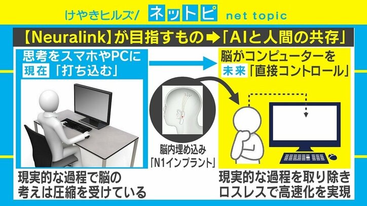 脳内埋め込み“チップ”で考えるだけでスマホ入力！ イーロン・マスク氏の新プロジェクトを徹底解説