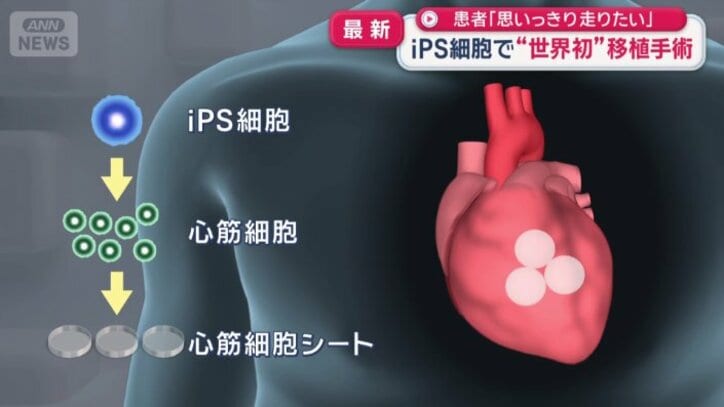 心臓に貼ることで血管の再生を促し、機能を回復させる