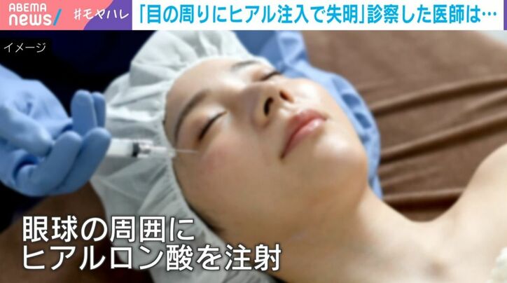施術を受ける女性（イメージ）
