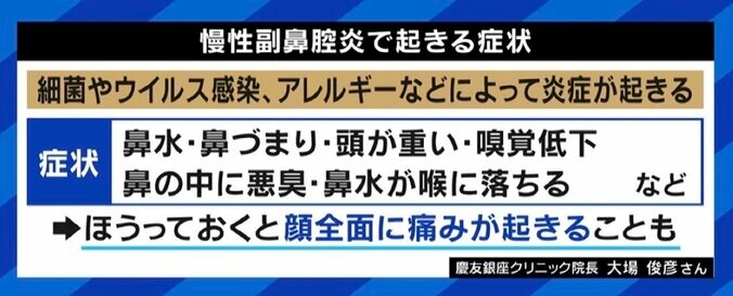 総理手術の副鼻腔炎 “鼻づまり”は失礼？ 田中萌アナ「同じ病でつらい人はショック。どういう気持ちで言ってるんだろう」 1枚目