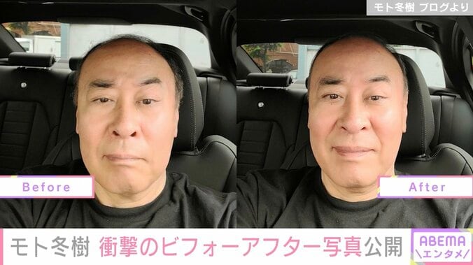 モト冬樹、ヘアカットのビフォーアフターを公開も「全然わからない」と話題に 1枚目