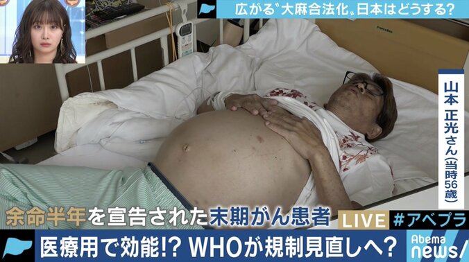 嗜好品、医療用として大きなビジネスチャンスに…先進国でも”大麻解禁”の流れ、日本はどうすべき？ 3枚目