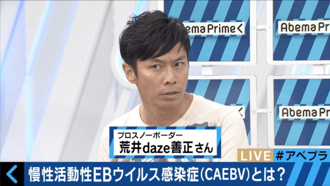 声優・松来未祐の命奪った難病「CAEBV」とは？　専門家が解説 3枚目