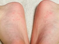 佐藤友美『もう？季節の変わり目？？？』