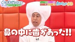 「鼻の中に歯が…」 ウエストランド井口の“衝撃告白”に共演者絶句