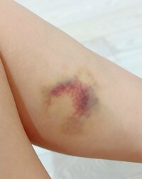 川崎希『ゾンビに噛まれた』