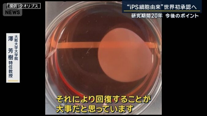 心筋細胞シート