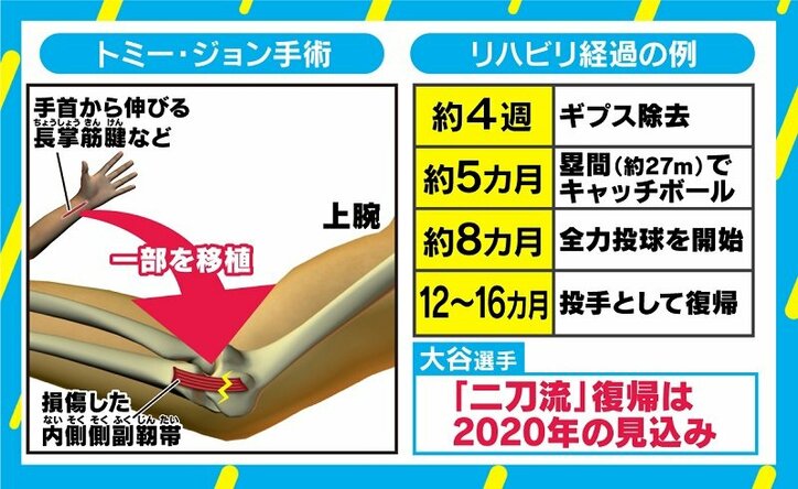 古田敦也氏、大谷翔平の右ひじ手術決断は「最高のタイミング」　2つの理由