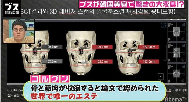 足で腹肉や顔を踏みつける…韓国の激痛エステ「コルグン」の効果とは？