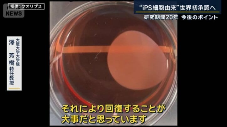 心筋細胞シート