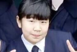 「顔はやってないところがない」400万円の整形で激変した美女、ビフォーアフターに絶賛の声「可愛い！」