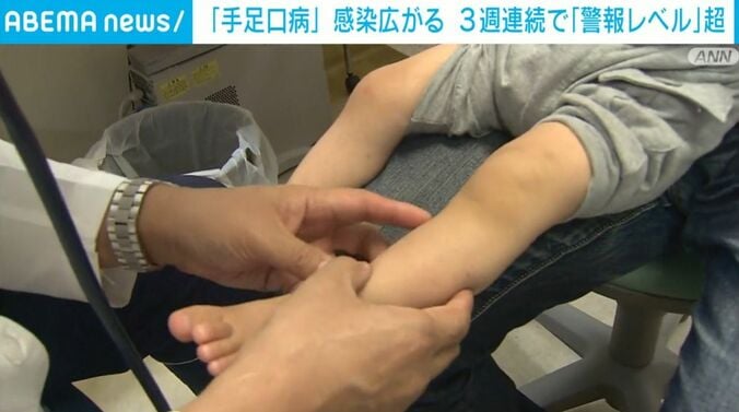 子どもの脚