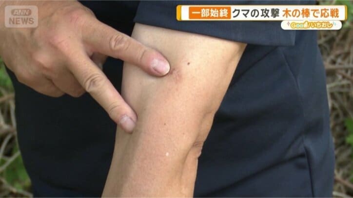 傷跡は今も…