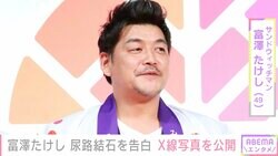 サンド富澤、体調不良や血尿で病院へ「ありました、尿路結石！」再発を報告