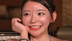 「整形総額2000万円」デリケートゾーンも整形した26歳キャバ嬢「鼻だけコンプレックスで…」課金が止まらなくなった理由