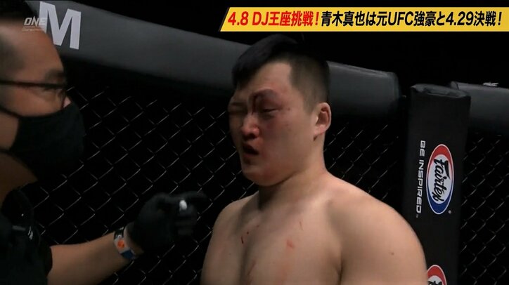 ヘビー級、右フック２発で顔面崩壊…敗色濃厚からの“一撃”逆転KO！ まるで敗者のような顔の勝者「僕は噛ませ犬だとわかっていた」