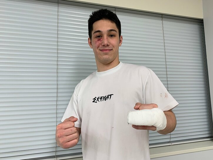 ボクシング高校“6冠” 宇佐美正パトリック、拳で切り拓く激変人生「父に世界一のベルトを」