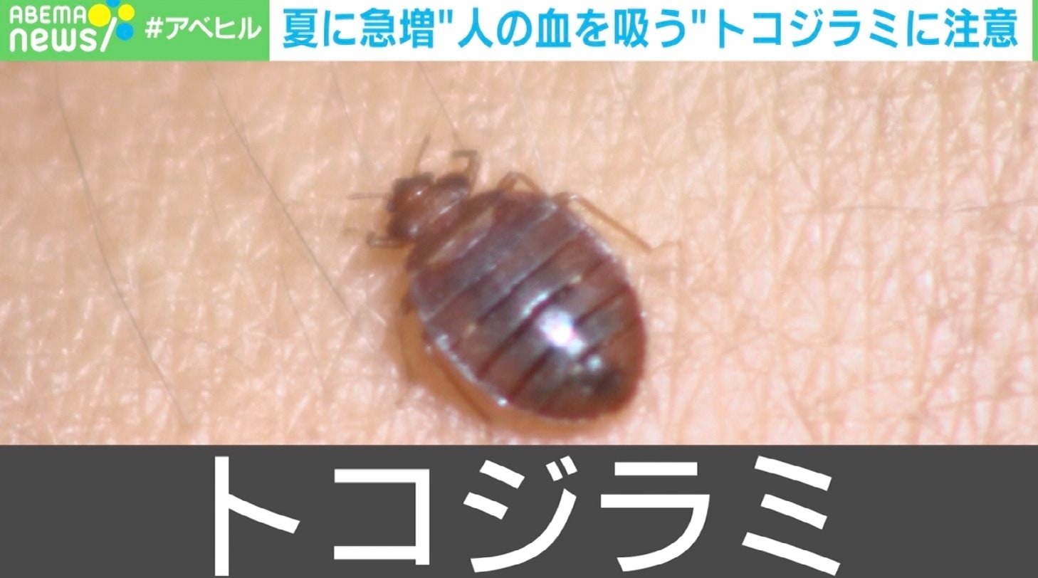 人の血を吸う トコジラミ が夏に急増 家庭用の殺虫剤は効果なし 駆除法を専門家に聞く 国内 Abema Times