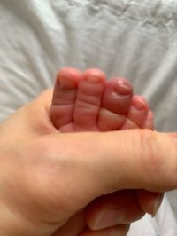 紺野あさ美『赤ちゃんの指に髪の毛が絡まる』