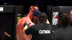 「これは事件だ！」実況が絶叫 大流血の“斜め上”を行く驚きのTKO決着に「そっちかいw」ツッコミ殺到も