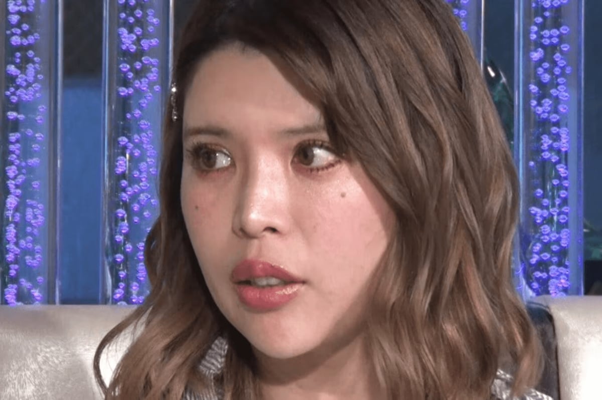 杏里 整形