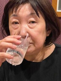 アレクサンダー『整形前と整形後　』