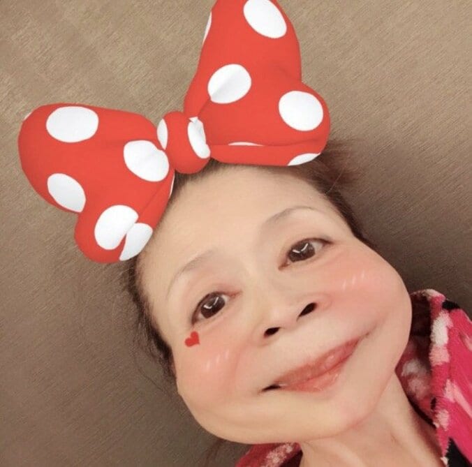 小柳ルミ子、歯周炎の口腔外科手術が終わり現状を報告「全然痛くなかったですよ！！」 2枚目