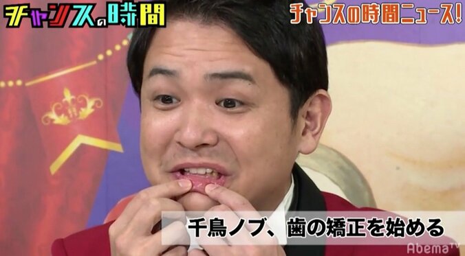 千鳥ノブ、歯列矯正を開始　総入れ歯で“クシャおじさん”になるところだった？ 1枚目