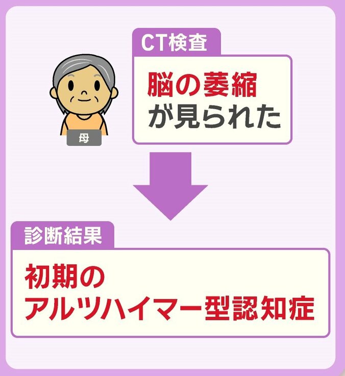 初期のアルツハイマー型認知症と診断