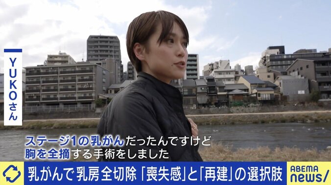 乳がんで全切除した当事者に聞く葛藤