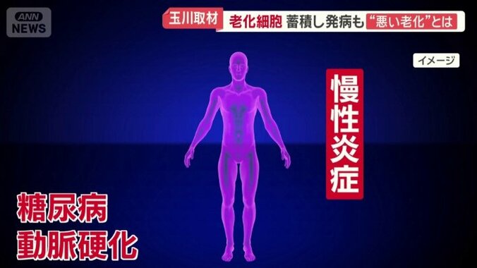 加齢に伴い病気が発症