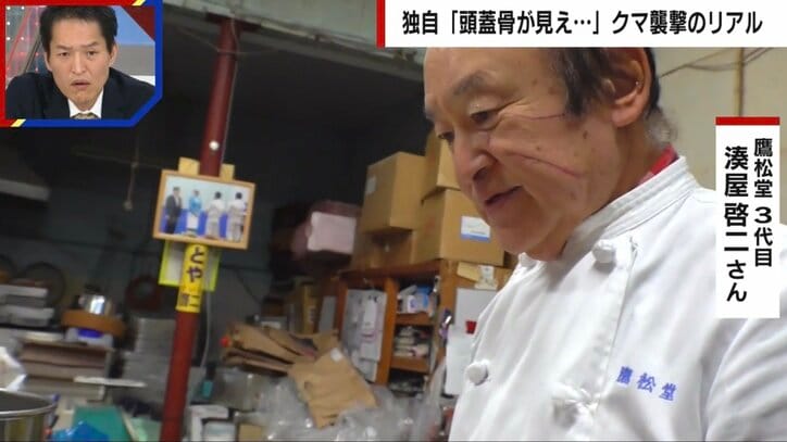 「頭蓋骨が開いてた。もう死ぬんだなと」クマ被害者を独自取材　頭は30針以上の怪我、耳たぶを噛みちぎられ、あと5mmで失明の恐れも…被害者が語った「恐怖の瞬間」